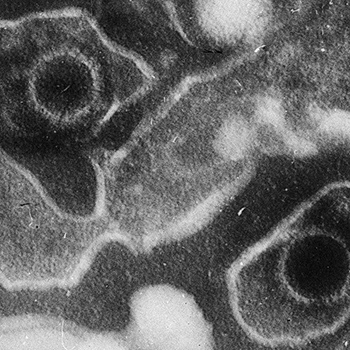 Di Liza Gross - (2005) Virus Proteins Prevent Cell Suicide Long Enough to Establish Latent Infection. PLoS Biol 3(12): e430 DOI: 10.1371/journal.pbio.0030430http://biology.plosjournals.org/perlserv?request=get-document&amp;doi=10.1371/journal.pbio.0030430, CC BY 2.5, https://commons.wikimedia.org/w/index.php?curid=861856